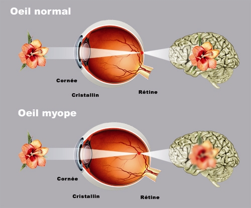 schéma oeil