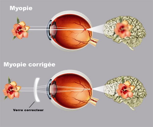 schéma oeil